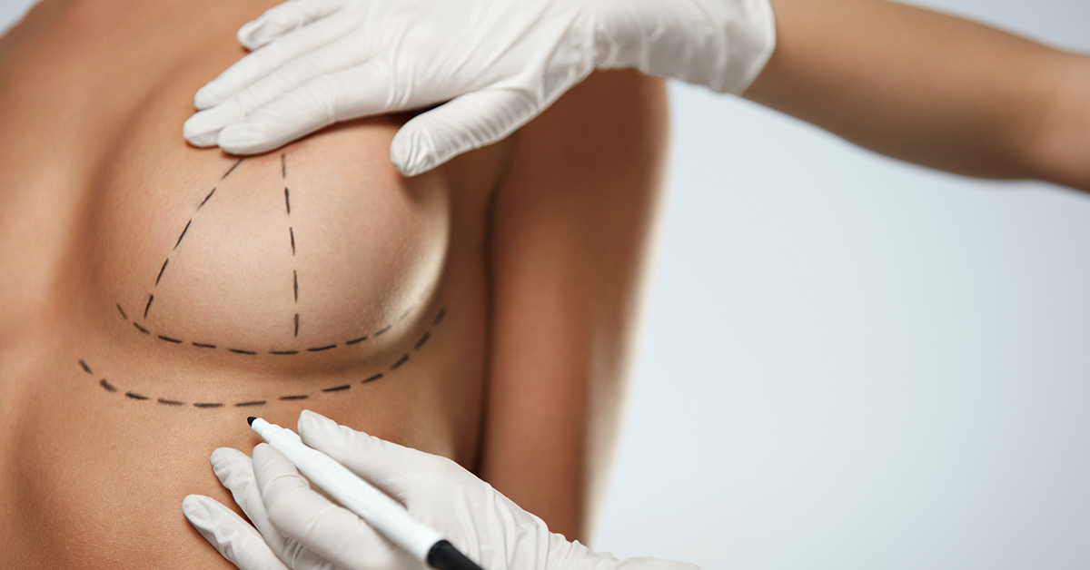 Breast Augmentation Recovery  American Society of Plastic Surgeons