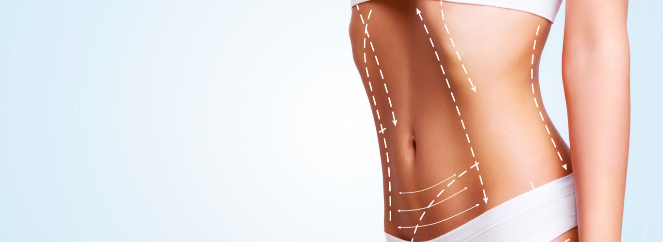 liposuction-gallery-1366×500
