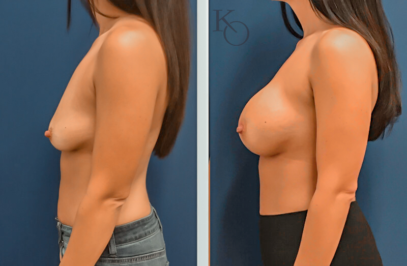 29029left-800×523