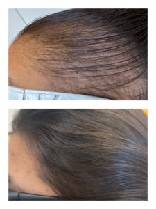 CC5TREATMENTS2023-3 (1)
