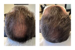 DA4TREATMENTS2024-2 (1)